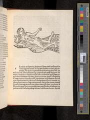 Go to image 181.